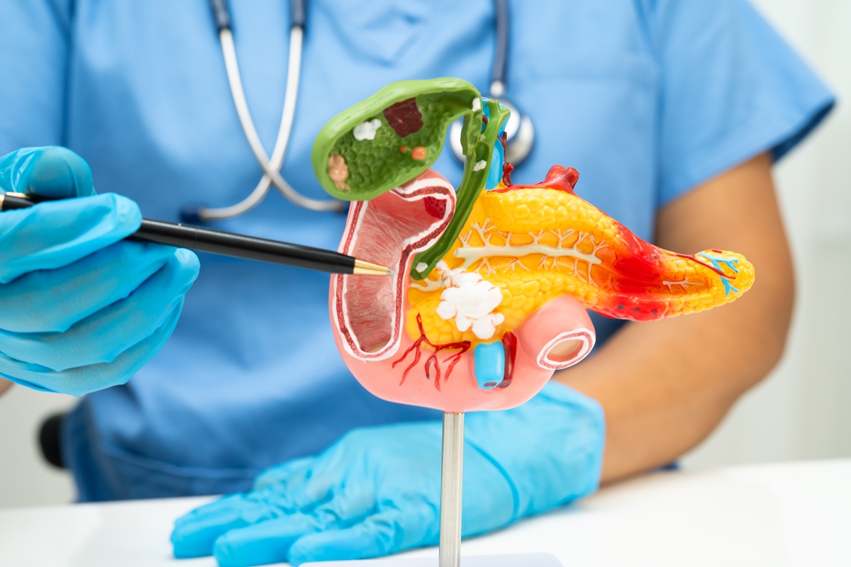 1 de 1 Foto colorida de médico com luvas apontando em direção a um pâncreas humano de mentira...