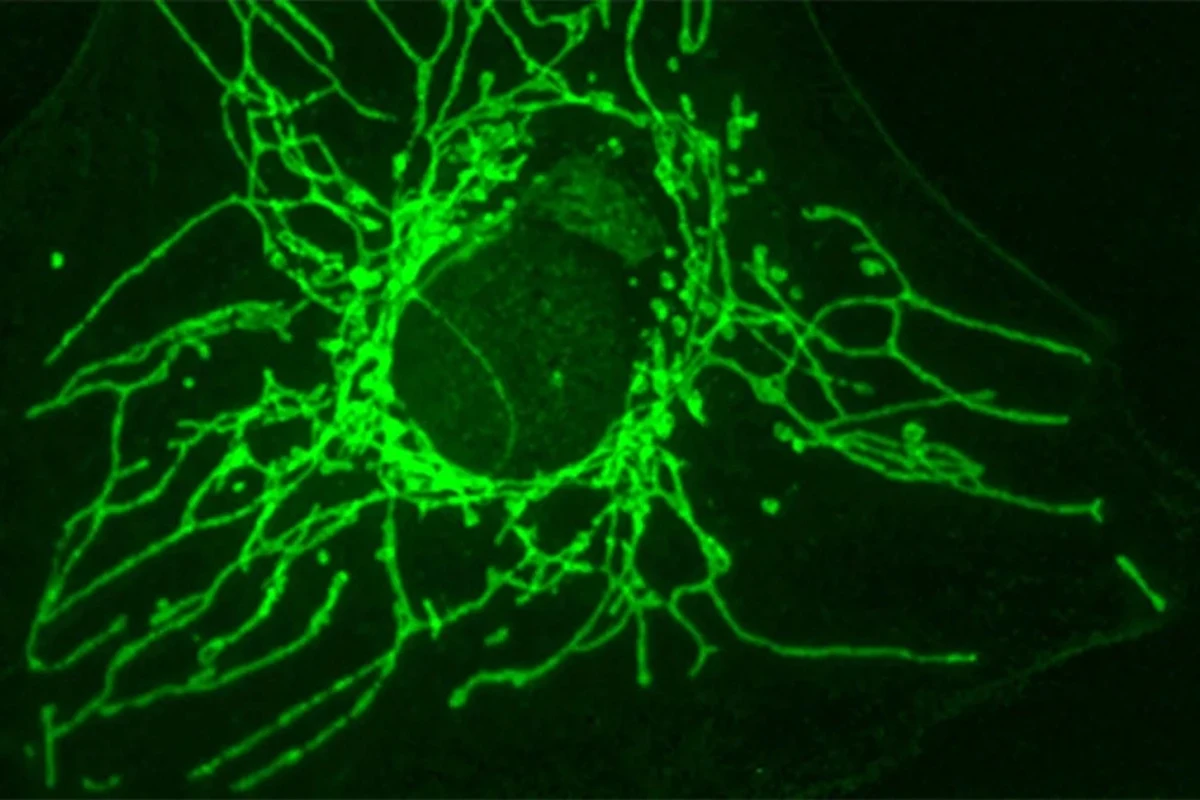 1 de 1 Célula cancerosa com mitocôndrias em verde — as centrais de energia da célula e locai...