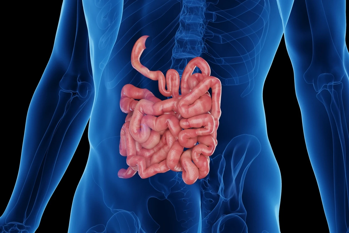 1 de 1 Ilustração colorida de intestino - Foto: SEBASTIAN KAULITZKI/SCIENCE PHOTO LIBRARY/Getty...