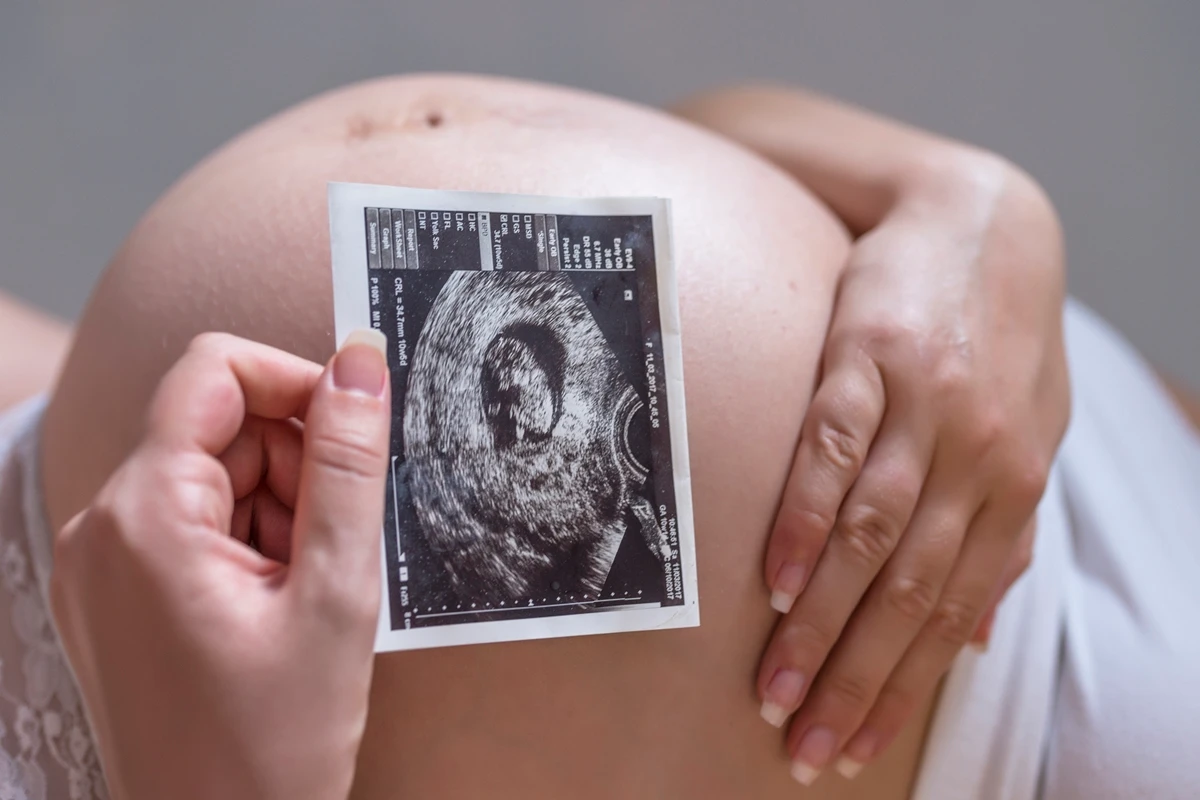 1 de 1 Foto colorida de mulher grávisa segurando uma foto de ultrassom em frente a barriga - Met...
