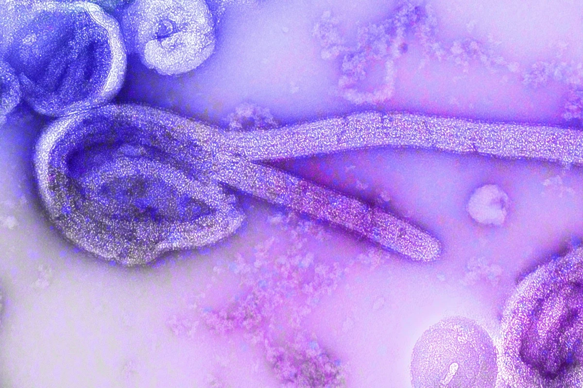 1 de 1 Vírus ebola. Metrópoles - Foto: Unsplash