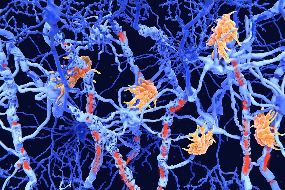 Juan Gaertner/Science Photo Library/Getty Images