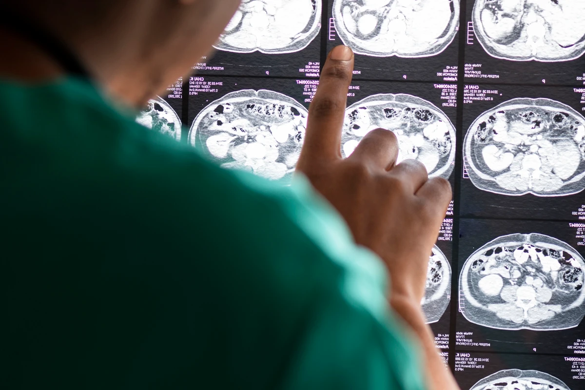 1 de 1 Imagem colorida de uma médica analisando raio-x de cérebro - Metrópoles - Foto: Magnific