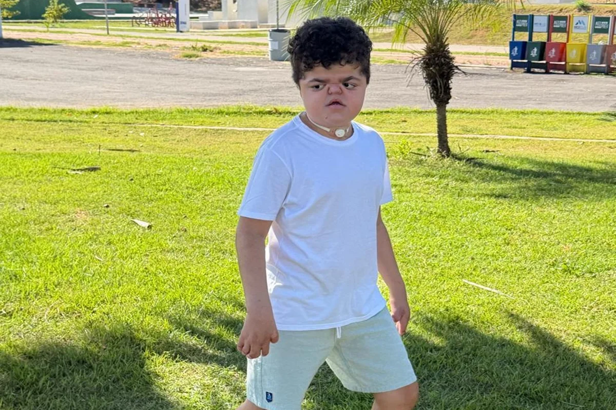 Menino com doença rara já fez 14 cirurgias e luta por nova operação