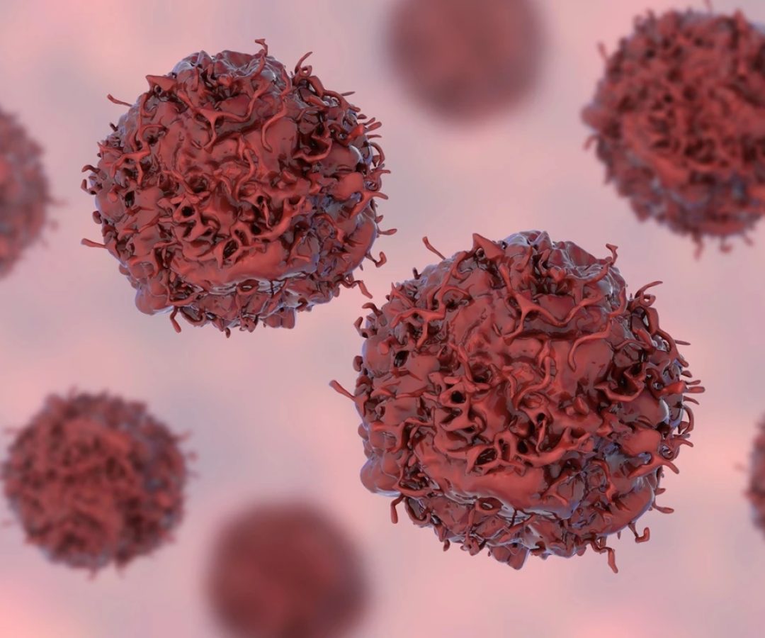 1 de 1 Ilustração colorida de células cancerígenas - 40% dos casos de câncer poderiam ser ev...
