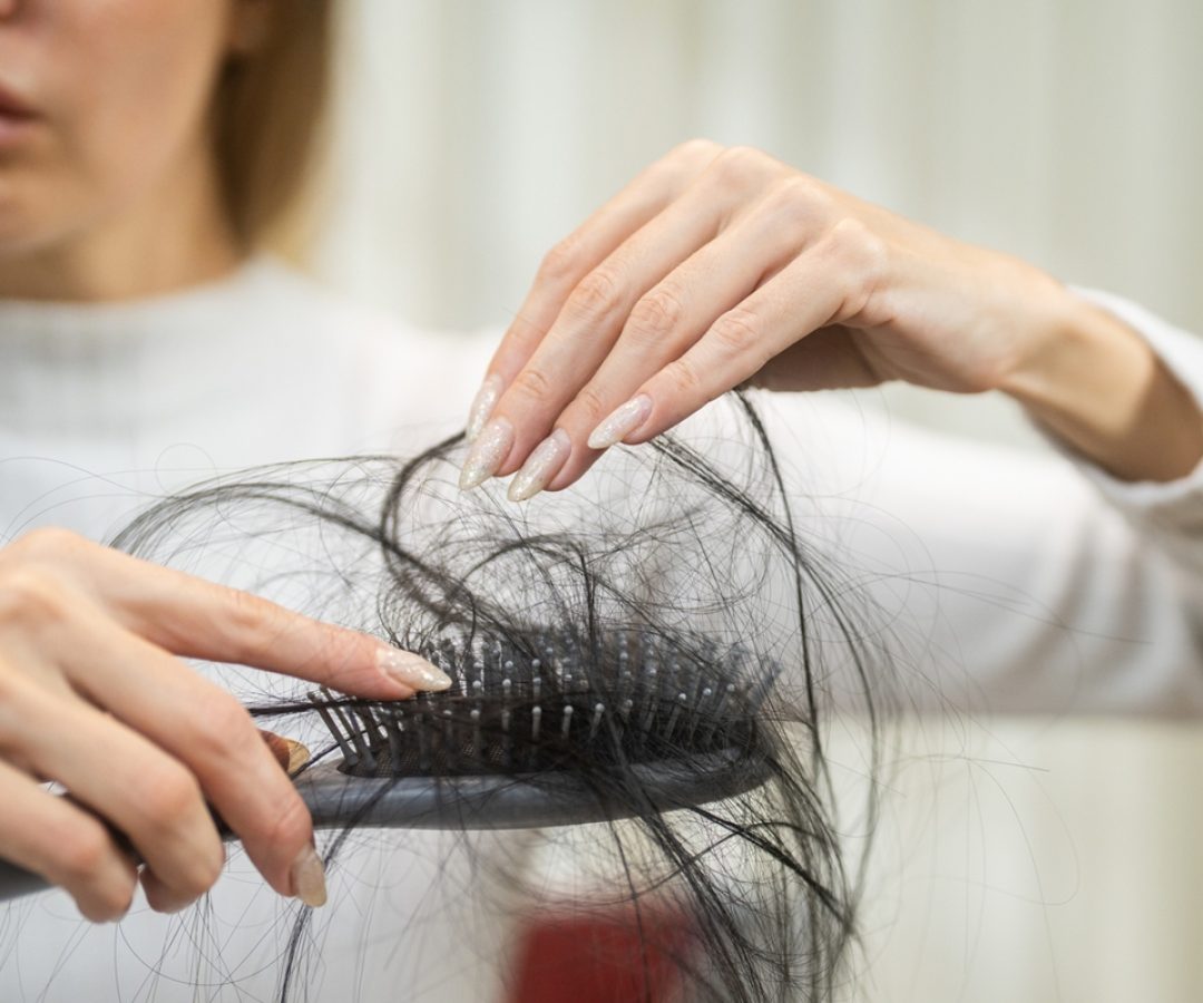 1 de 1 Foto colorida de mulher tirando cabelo de escova - Metrópoles - Foto: Witthaya Prasongsin...