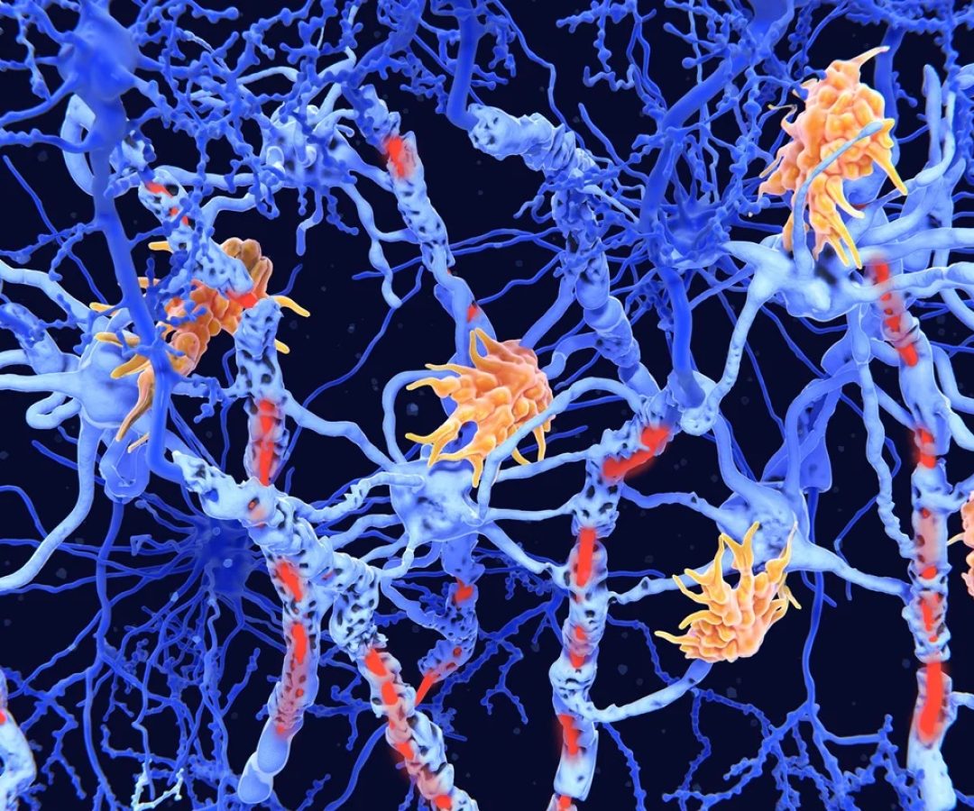 Juan Gaertner/Science Photo Library/Getty Images