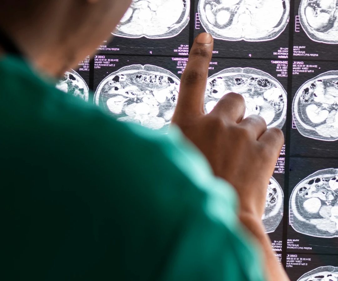 1 de 1 Imagem colorida de uma médica analisando raio-x de cérebro - Metrópoles - Foto: Magnific