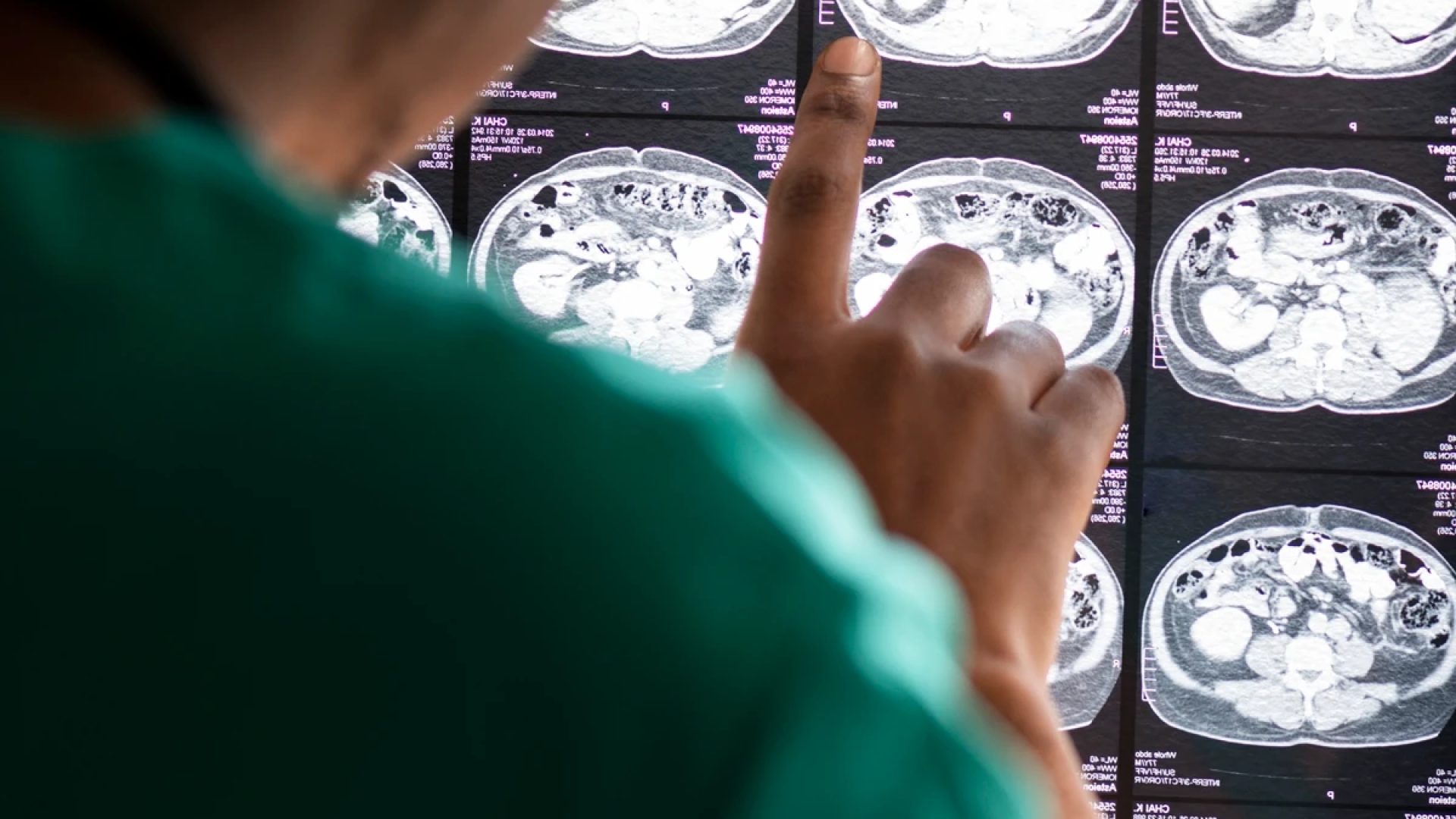 1 de 1 Imagem colorida de uma médica analisando raio-x de cérebro - Metrópoles - Foto: Magnific