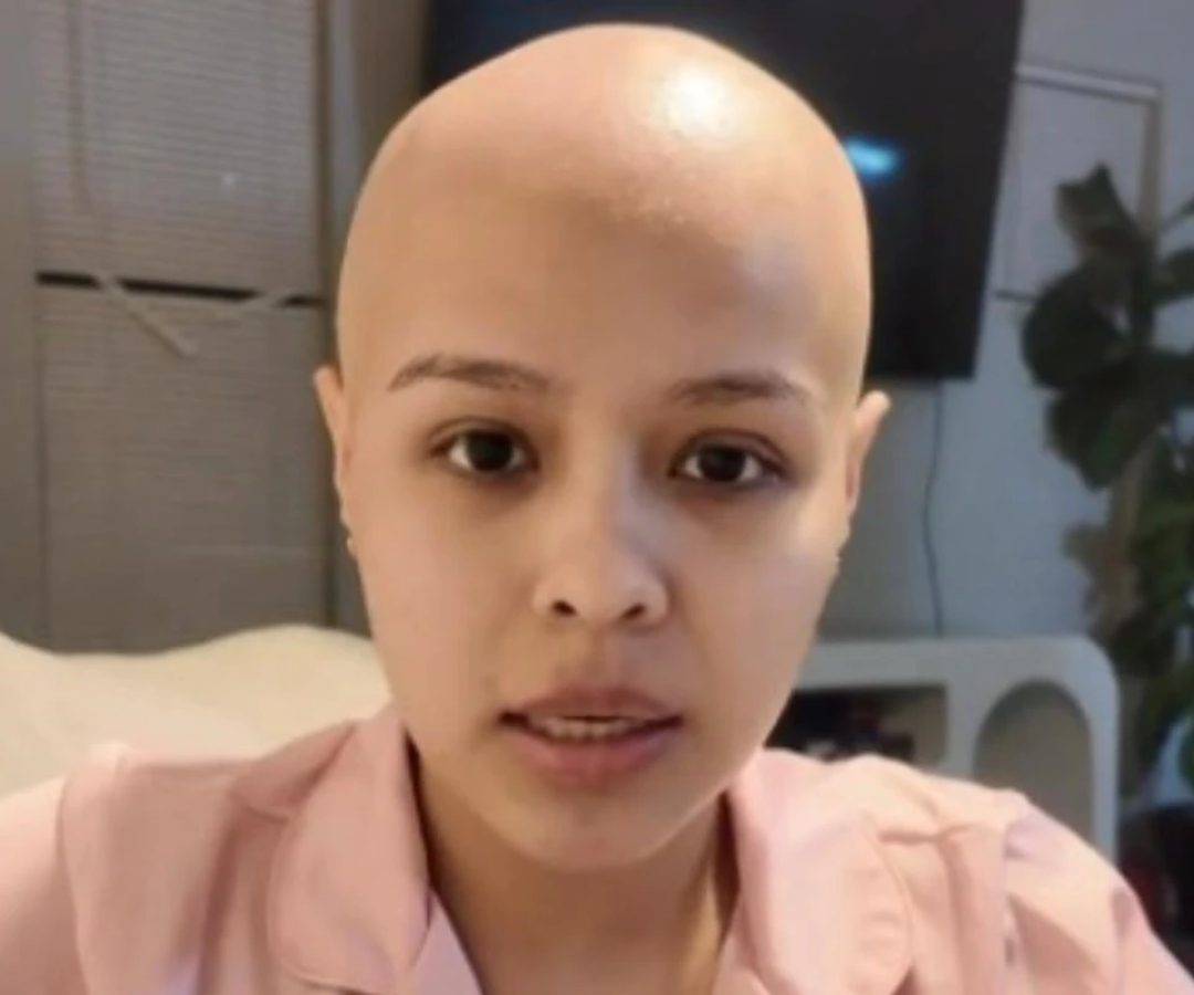 1 de 1 Foto colorida de mulher jovem com cabelo raspado após descoberta de cãncer - Metrópoles...