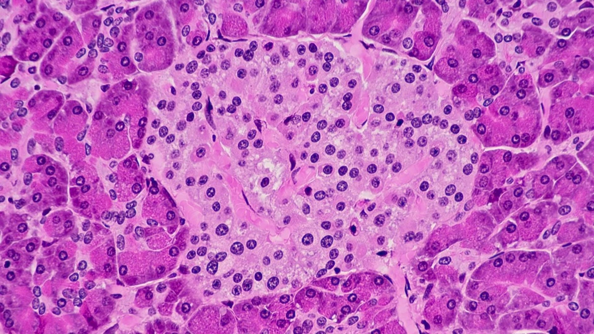 1 de 1 Imagem de microscópio tonalizada em rosa mostra área do fígado que secreta insulina - M...