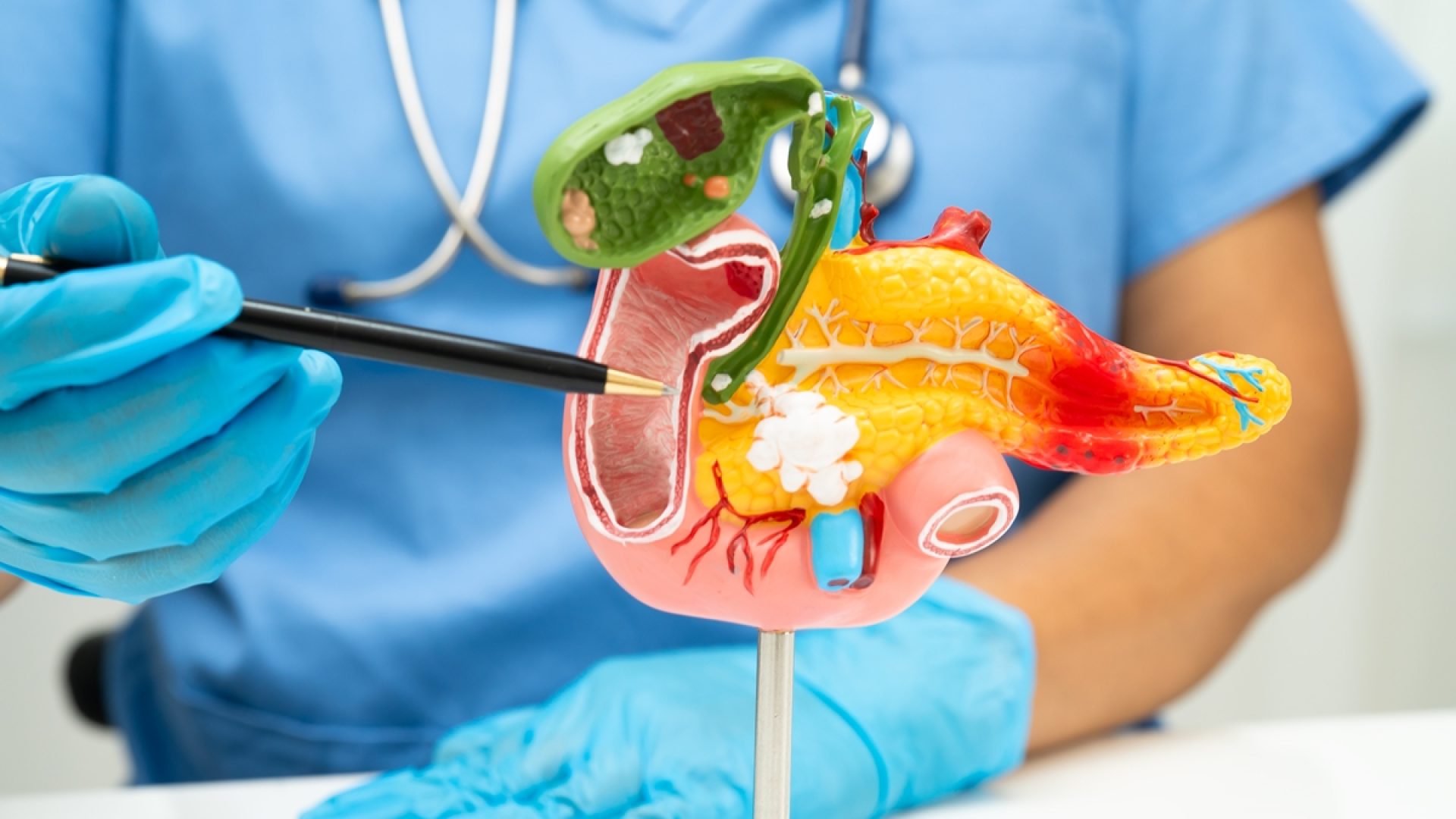 1 de 1 Foto colorida de médico com luvas apontando em direção a um pâncreas humano de mentira...