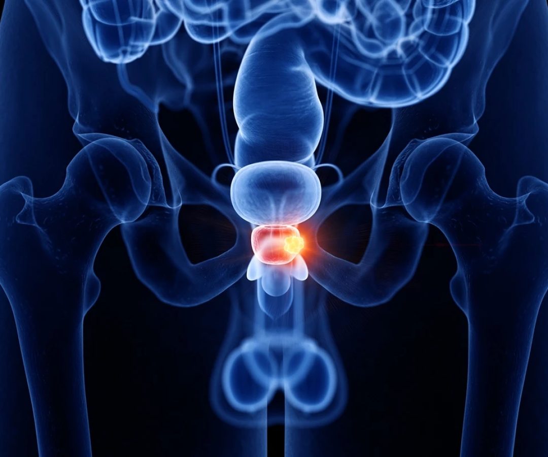 1 de 1 Ilustração colorida mostra próstata no corpo humano - Metrópoles - Foto: SEBASTIAN KAU...