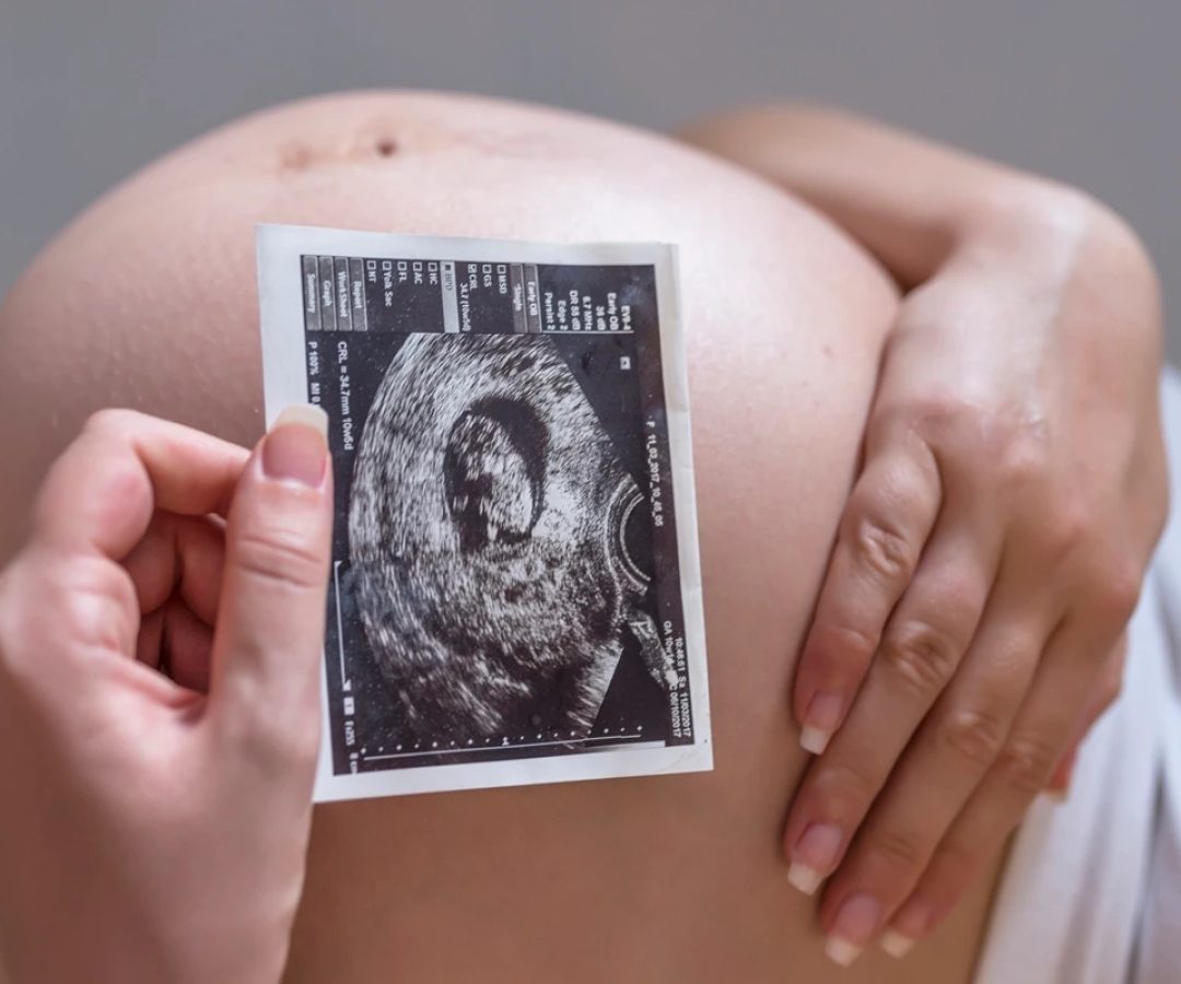 1 de 1 Foto colorida de mulher grávisa segurando uma foto de ultrassom em frente a barriga - Met...