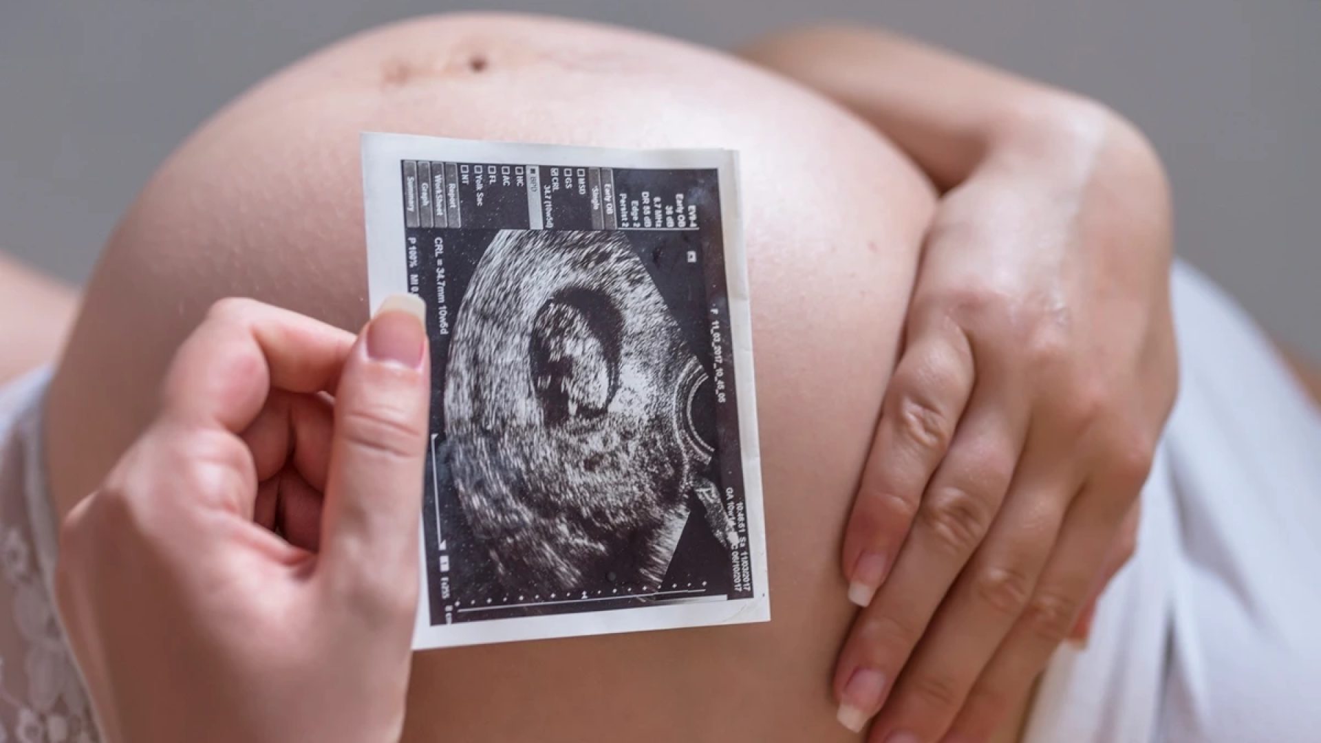 1 de 1 Foto colorida de mulher grávisa segurando uma foto de ultrassom em frente a barriga - Met...