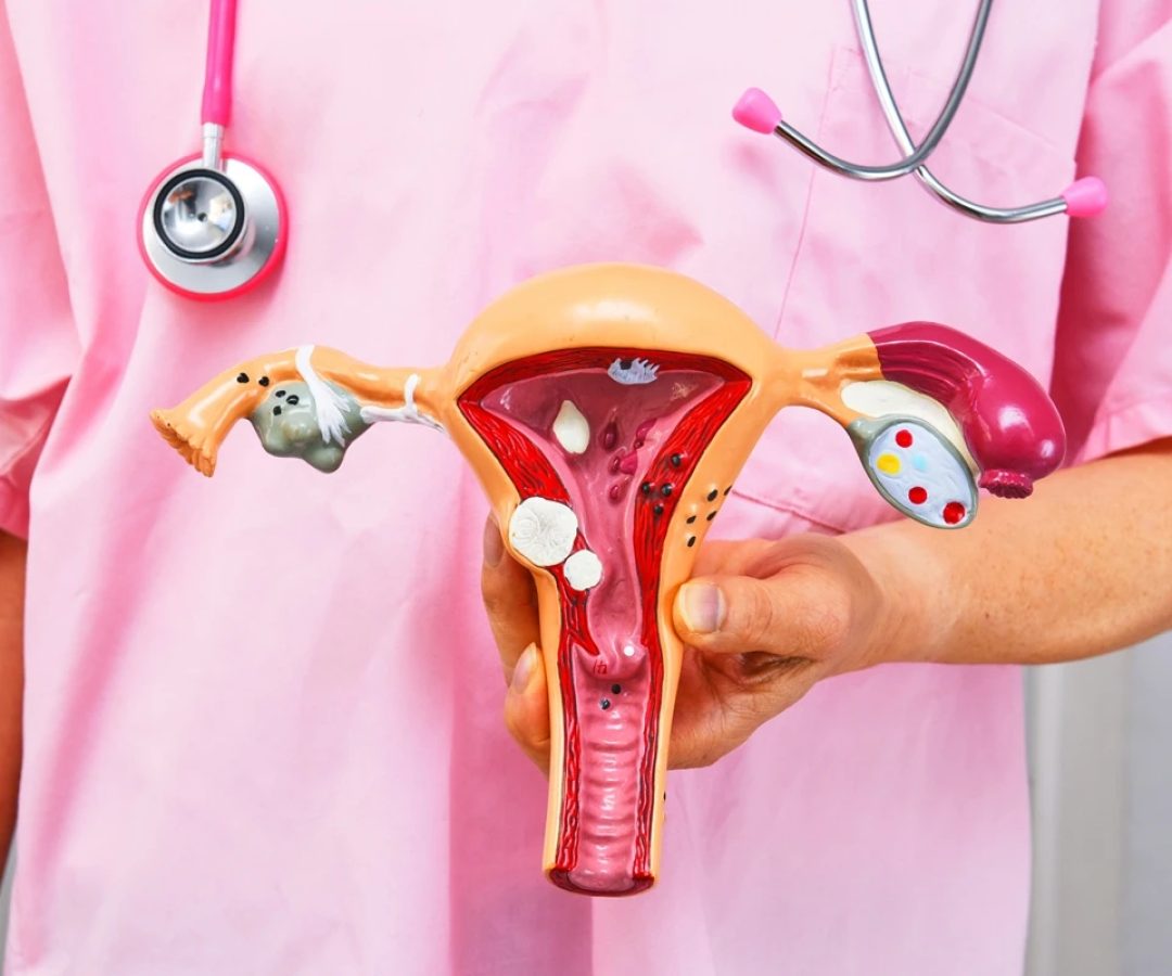 1 de 1 Cirurgião segurando modelo anatômico de patologias comuns. Conceito de câncer ou endome...