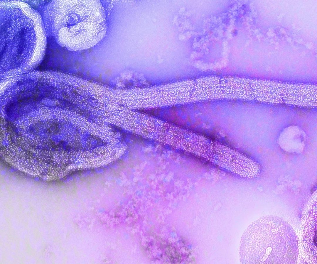 1 de 1 Vírus ebola. Metrópoles - Foto: Unsplash