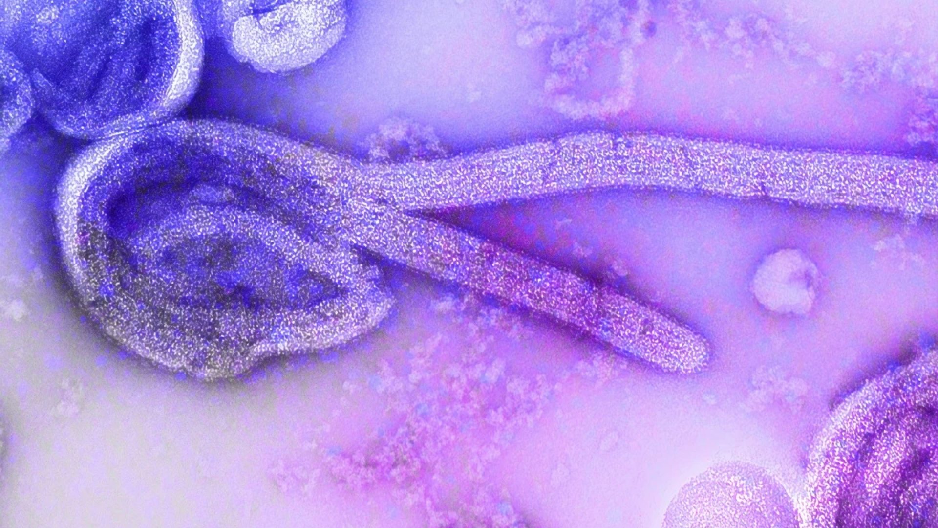 1 de 1 Vírus ebola. Metrópoles - Foto: Unsplash