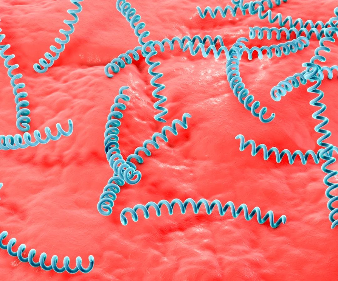 1 de 1 Ilustração computadorizada da Treponema pallidum, a bactéria causadora da sífilis. Met...