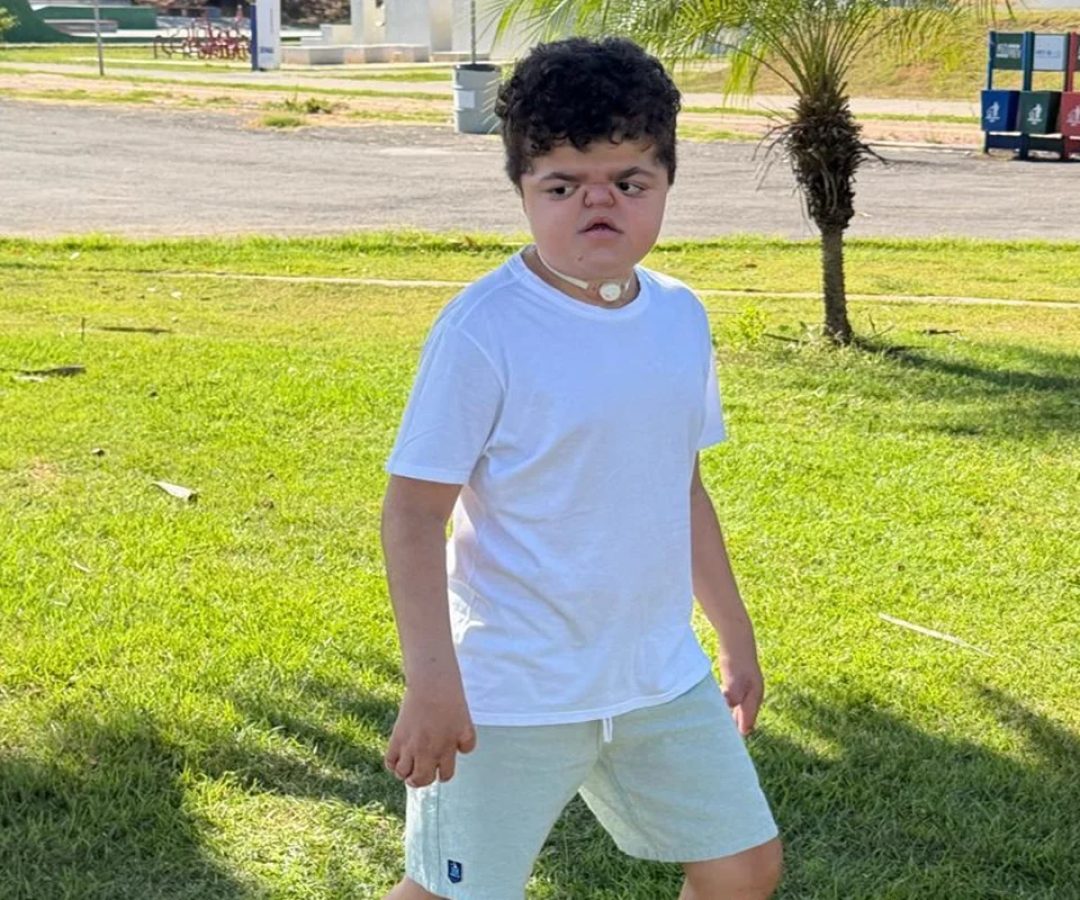 Menino com doença rara já fez 14 cirurgias e luta por nova operação