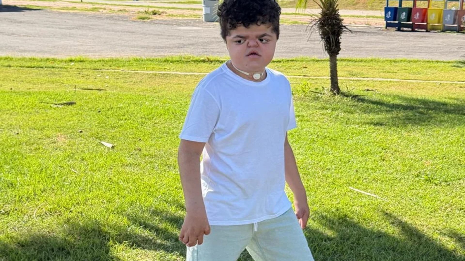 Menino com doença rara já fez 14 cirurgias e luta por nova operação